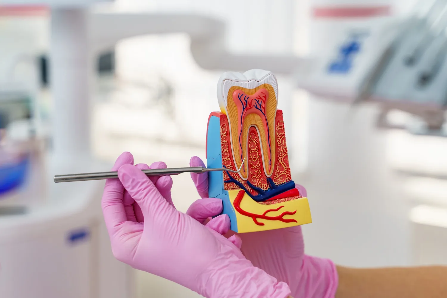 Recupera tu sonrisa con la Cirugía de recubrimiento de raíces en Naucalpan