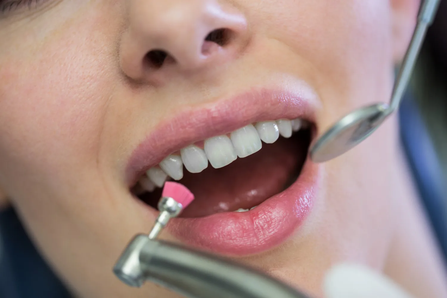Limpieza dental en Naucalpan: Salud bucal con el Dr. Ulises Xavier Diaz Mendoza