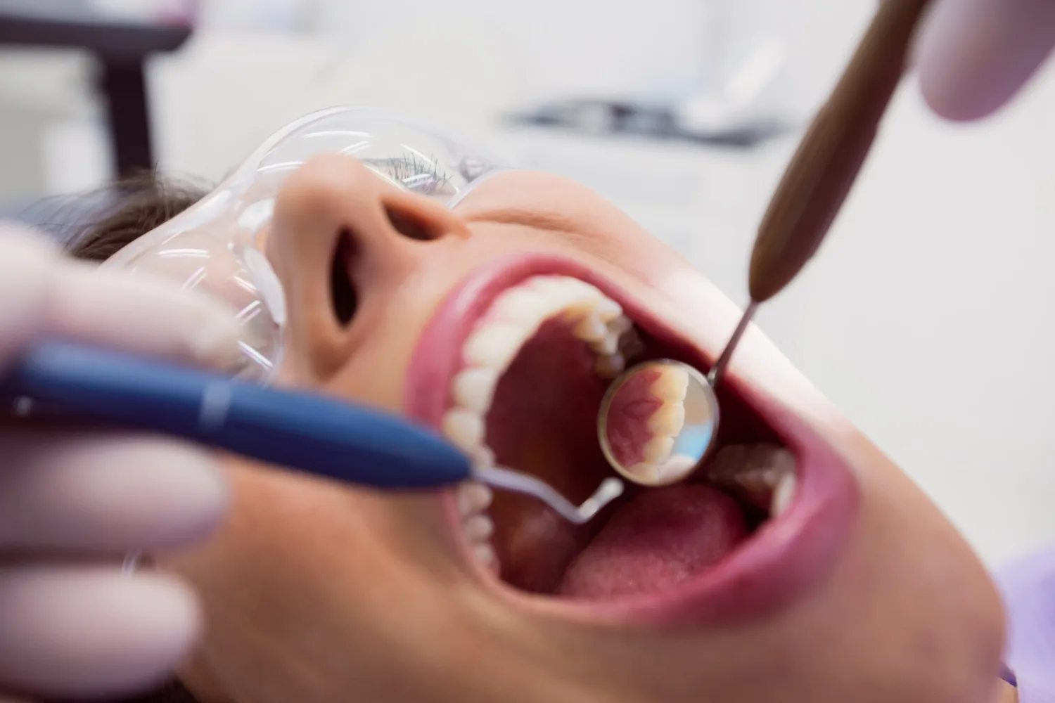 Resinas en Naucalpan: La solución estética y funcional para tu sonrisa con el Dr. Ulises Xavier Diaz Mendoza